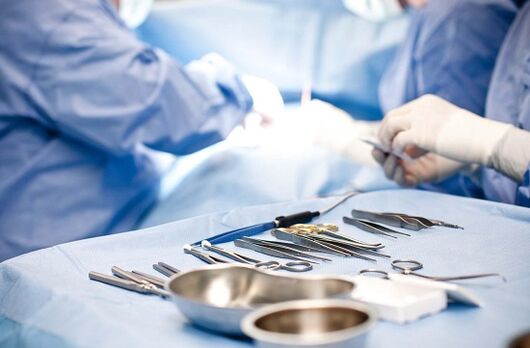 Chirurgische Intervention bei chronischer Prostatitis