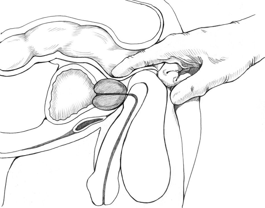 Die Prostatamassage gehört zum Komplex der Methoden zur Behandlung von Prostatitis